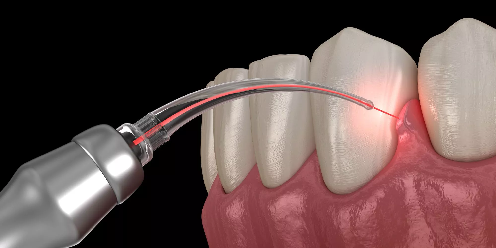 Ever Bright Digital Dental Center
